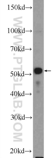 [25864-1-AP-150UL] PLAGL1 Polyclonal antibody
