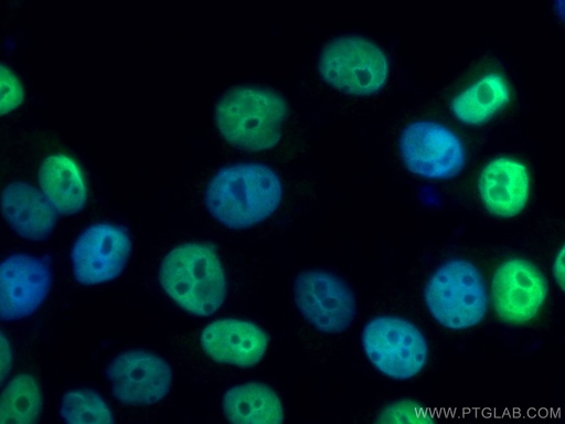 [25871-1-AP-20UL] PR Polyclonal antibody