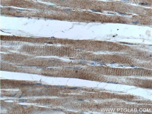 [25874-1-AP-20UL] HKDC1 Polyclonal antibody