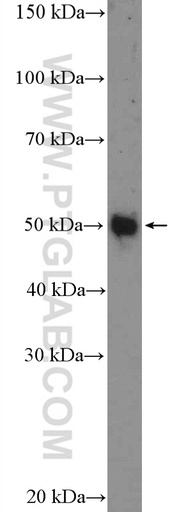 [25881-1-AP-20UL] Whirlin Polyclonal antibody