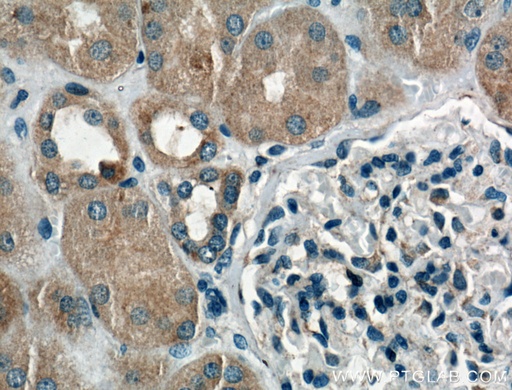 [25887-1-AP-150UL] Chk1 Polyclonal antibody