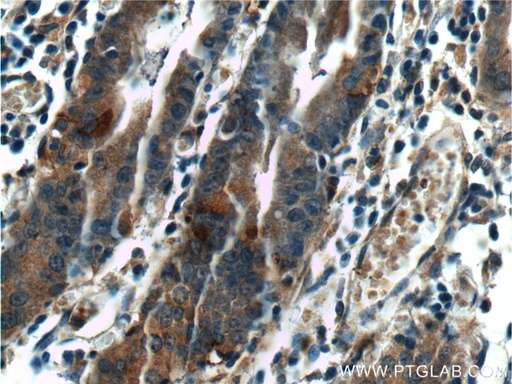 [25889-1-AP-150UL] LIPF Polyclonal antibody