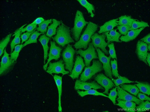 [25890-1-AP-150UL] TRPC5 Polyclonal antibody