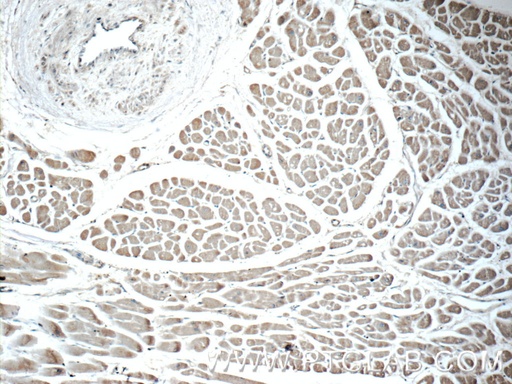 [25892-1-AP-20UL] EDA Polyclonal antibody