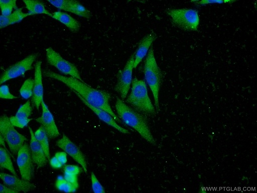 [25896-1-AP-150UL] MTR Polyclonal antibody