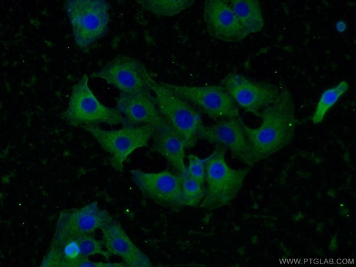 [25897-1-AP-150UL] KIF5C Polyclonal antibody