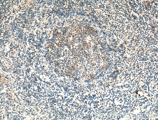 [25898-1-AP-20UL] CCR7 Polyclonal antibody