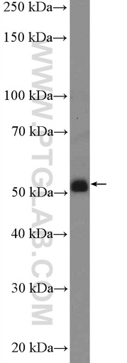 [25899-1-AP-150UL] GABRR1 Polyclonal antibody