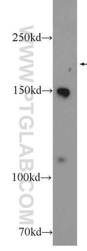 [25904-1-AP-150UL] PIK3C2G Polyclonal antibody