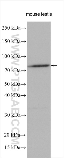 [25913-1-AP-20UL] TRIM36 Polyclonal antibody
