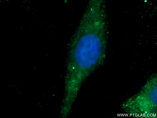 [25917-1-AP-150UL] GMIP Polyclonal antibody
