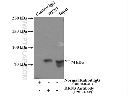 [25918-1-AP-150UL] RRN3 Polyclonal antibody