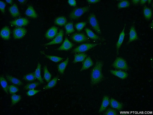 [25925-1-AP-150UL] APOL2 Polyclonal antibody