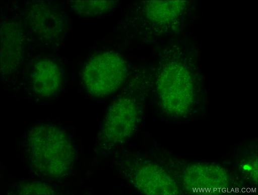 [25926-1-AP-150UL] SNW1 Polyclonal antibody