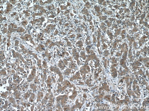 [25930-1-AP-20UL] IQGAP3 Polyclonal antibody