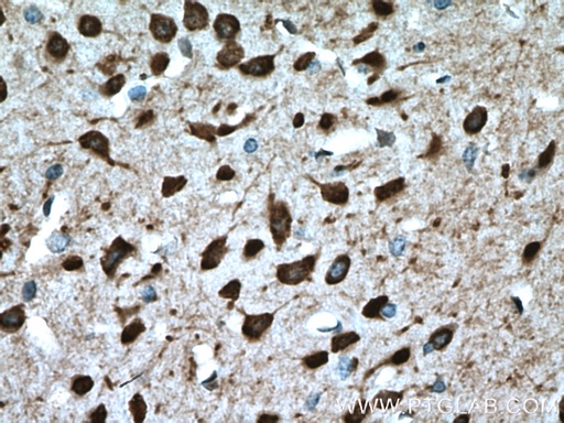 [25933-1-AP-20UL] PCP4L1 Polyclonal antibody