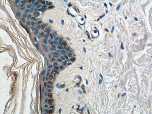 [25940-1-AP-20UL] HAL Polyclonal antibody