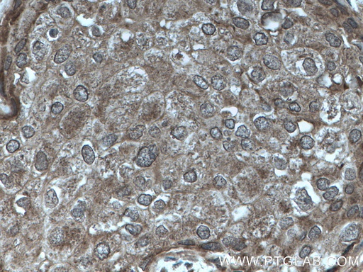 [25944-1-AP-150UL] PTPN13 Polyclonal antibody