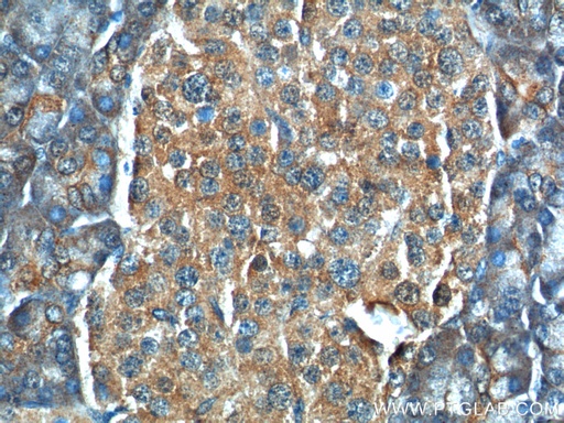 [25957-1-AP-20UL] C11orf80 Polyclonal antibody