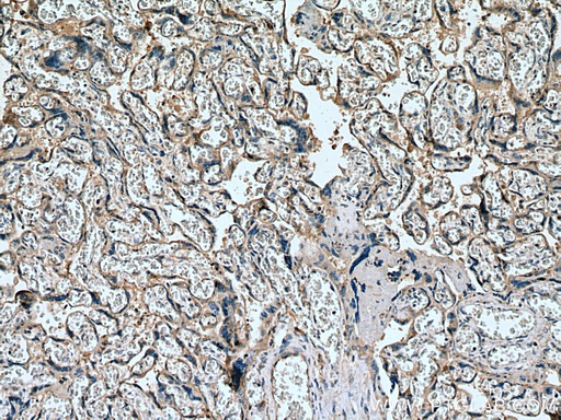 [25958-1-AP-150UL] SLC19A1 Polyclonal antibody