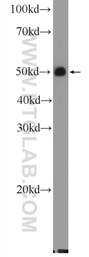[25962-1-AP-150UL] UT-B Polyclonal antibody