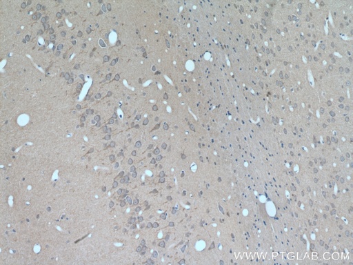 [25967-1-AP-150UL] GALNT9 Polyclonal antibody