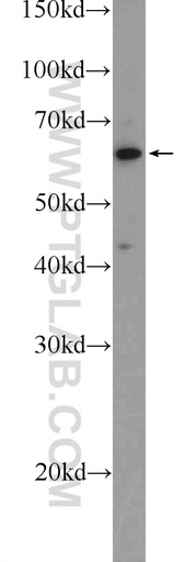 [25975-1-AP-20UL] TESPA1 Polyclonal antibody
