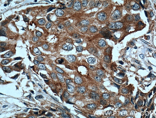 [25978-1-AP-20UL] c-SRC Polyclonal antibody
