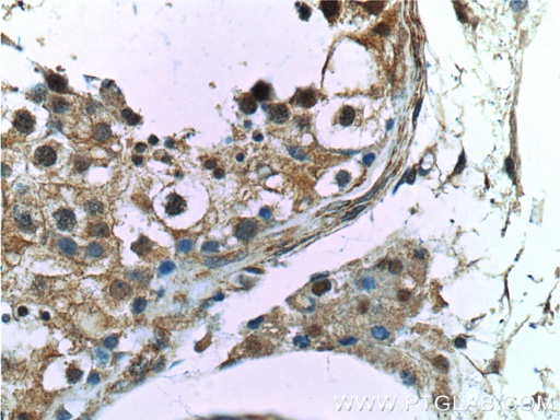 [25981-1-AP-150UL] CCDC62 Polyclonal antibody