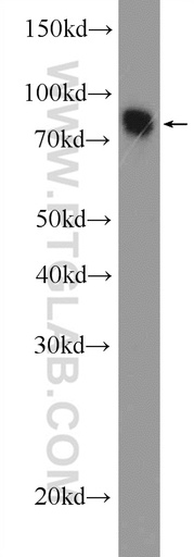 [25990-1-AP-150UL] MTMR7 Polyclonal antibody