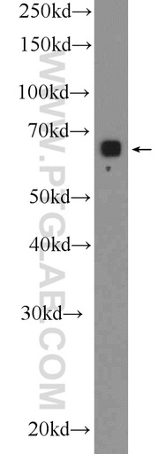 [25993-1-AP-20UL] GLT25D2 Polyclonal antibody