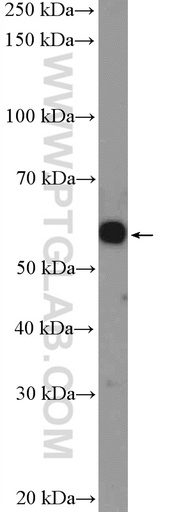 [25994-1-AP-20UL] C4orf18 Polyclonal antibody