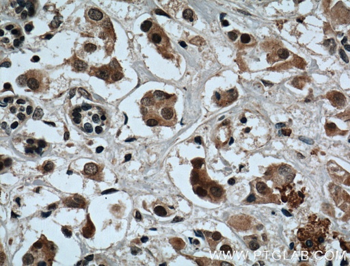 [25997-1-AP-20UL] XBP-1U specific Polyclonal antibody