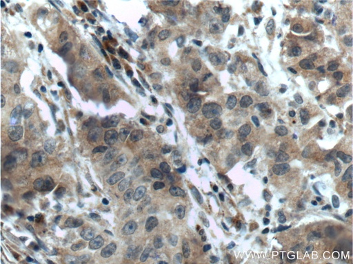 [26001-1-AP-20UL] SRD5A1 Polyclonal antibody