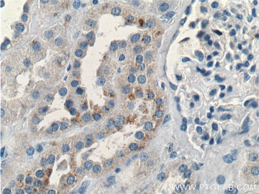 [26004-1-AP-20UL] BRAP Polyclonal antibody