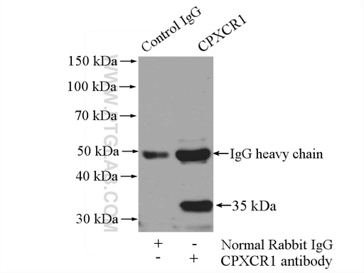 [26005-1-AP-20UL] CPXCR1 Polyclonal antibody