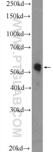 [26009-1-AP-20UL] TRMT61B Polyclonal antibody