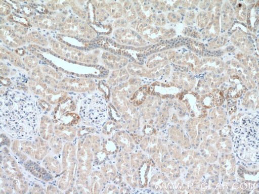 [26013-1-AP-20UL] CEP83 Polyclonal antibody