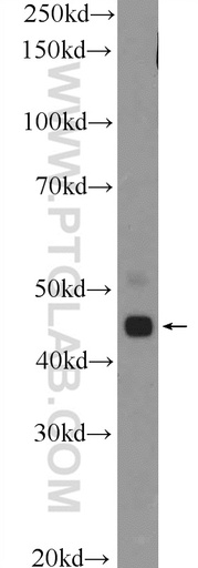 [26014-1-AP-150UL] TTLL10 Polyclonal antibody