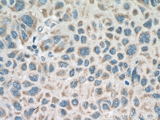 [26015-1-AP-150UL] RNF128 Polyclonal antibody