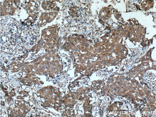 [26017-1-AP-150UL] KIAA0090 Polyclonal antibody