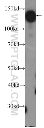 [26018-1-AP-150UL] HISPPD1 Polyclonal antibody