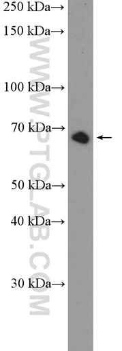 [26024-1-AP-20UL] FAM116B Polyclonal antibody