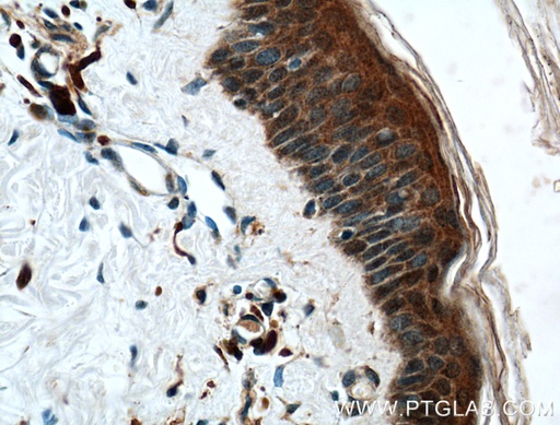 [26025-1-AP-150UL] CHRNA9 Polyclonal antibody