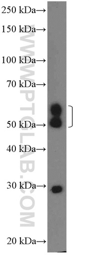 [26027-1-AP-150UL] CHST2 Polyclonal antibody