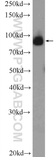 [26029-1-AP-150UL] C2orf3 Polyclonal antibody