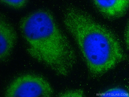 [26034-1-AP-150UL] C9orf9 Polyclonal antibody