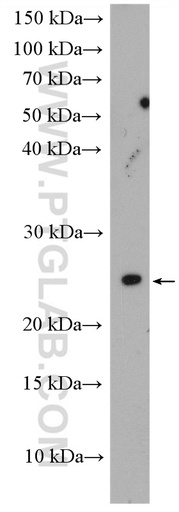 [26036-1-AP-150UL] CEP19 Polyclonal antibody