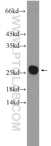 [26037-1-AP-150UL] C16orf45 Polyclonal antibody