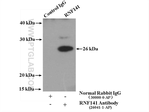 [26041-1-AP-150UL] RNF141 Polyclonal antibody